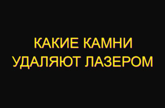 Какие камни удаляют лазером