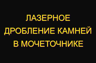Лазерное дробление камней в мочеточнике
