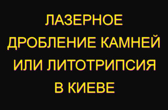 Лазерное дробление камней или литотрипсия В Киеве